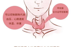 女子甲状腺结节变癌,从忽视到癌变的惊醒