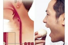 早期食道癌能治好吗,早期食道癌治愈可能性分析